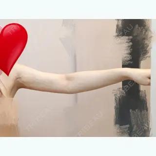 25日目の経過画像（2枚目）