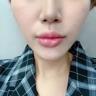 6日目の経過画像（1枚目）