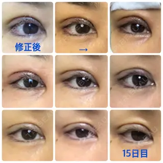 22日目の経過画像（1枚目）