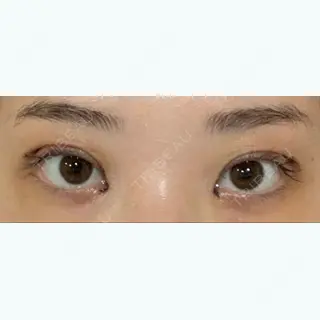 7日目の経過画像（1枚目）