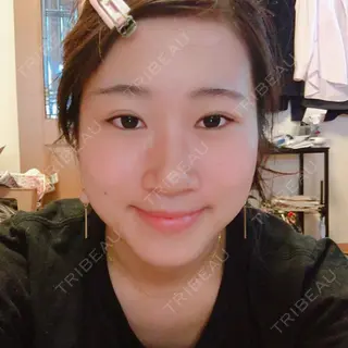 9日目の経過画像（2枚目）