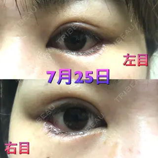 9日目の経過画像（2枚目）