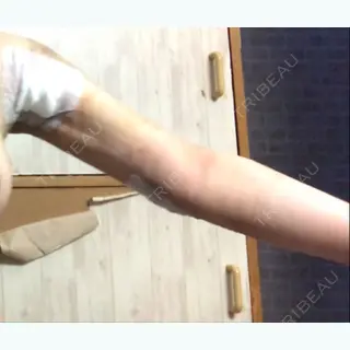 3日目の経過画像（2枚目）