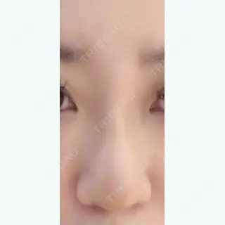 3日目の経過画像（1枚目）