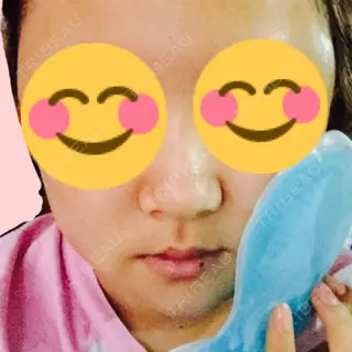 2日目の経過画像（1枚目）