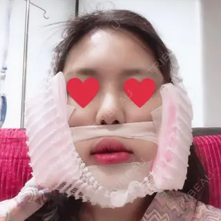 0日目の経過画像（1枚目）