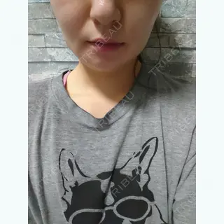 2日目の経過画像（1枚目）