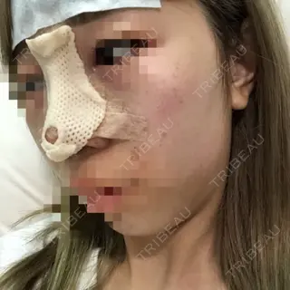 1日目の経過画像（3枚目）