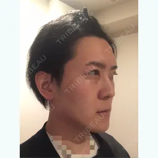 9日目の経過画像（2枚目）