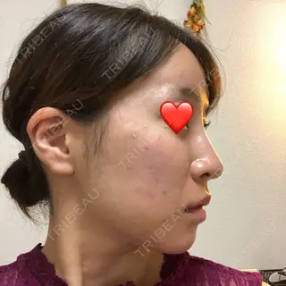 8日目の経過画像（1枚目）