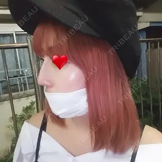3日目の経過画像（2枚目）