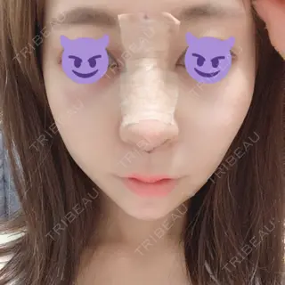 2日目の経過画像（1枚目）
