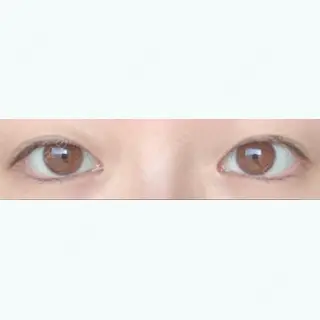 141日目の経過画像（1枚目）