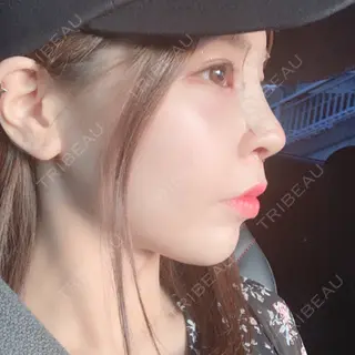 3日目の経過画像（2枚目）