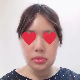 2日目の経過画像（1枚目）