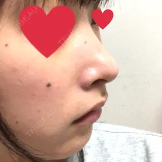 1日目の経過画像（2枚目）