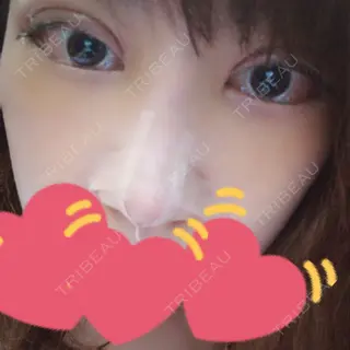 5日目の経過画像（1枚目）