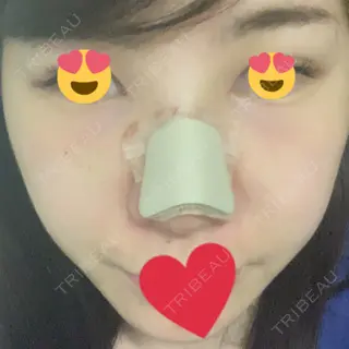 3日目の経過画像（2枚目）