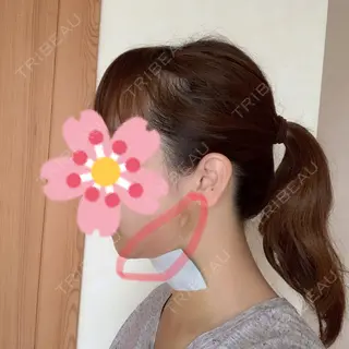 3日目の経過画像（3枚目）