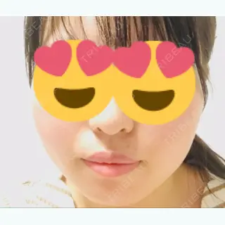 3日目の経過画像（1枚目）