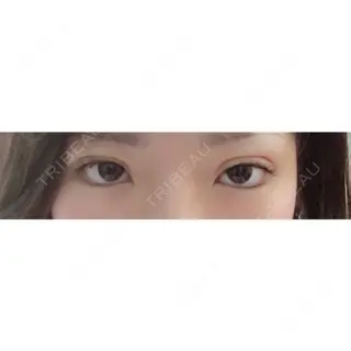1日目の経過画像（1枚目）