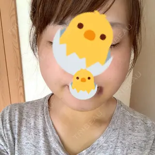 4日目の経過画像（1枚目）