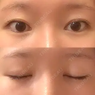 260日目の経過画像（1枚目）