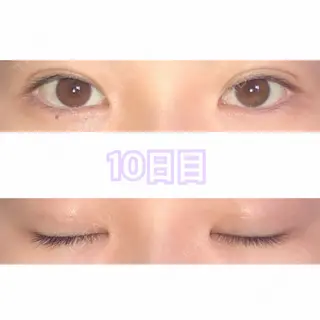 10日目の経過画像（1枚目）