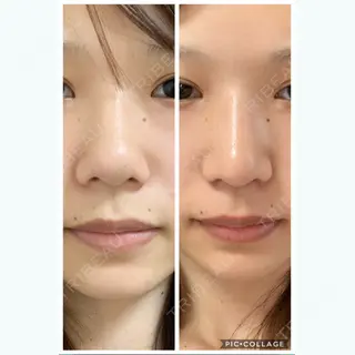 26日目の経過画像（1枚目）