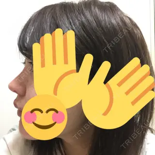 169日目の経過画像（2枚目）