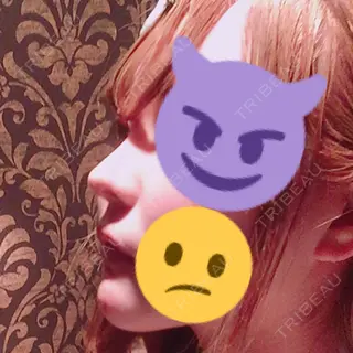 169日目の経過画像（3枚目）