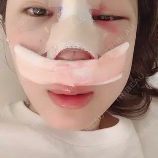 1日目の経過画像（1枚目）