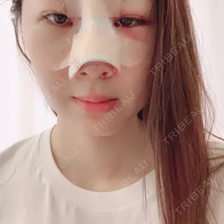 2日目の経過画像（1枚目）