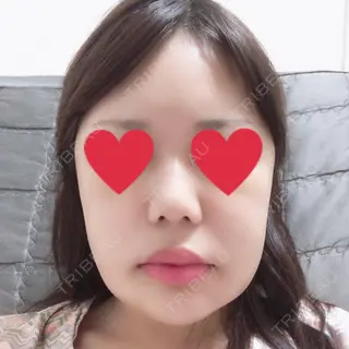 7日目の経過画像（1枚目）