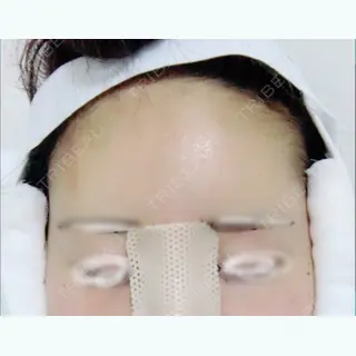 1日目の経過画像（2枚目）