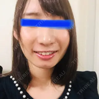 16日目の経過画像（3枚目）