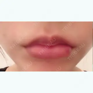 1日目の経過画像（1枚目）