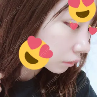 9日目の経過画像（2枚目）