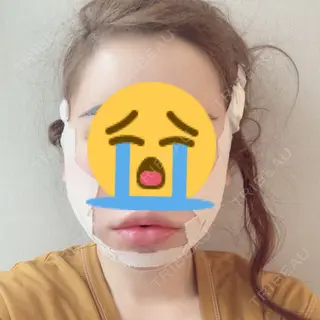 1日目の経過画像（1枚目）