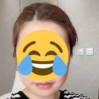 3日目の経過画像（1枚目）