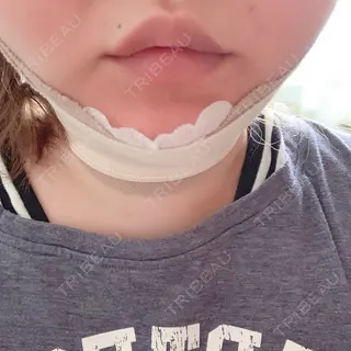 1日目の経過画像（1枚目）