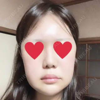 9日目の経過画像（1枚目）