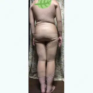 10日目の経過画像（3枚目）