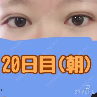 21日目の経過画像（1枚目）