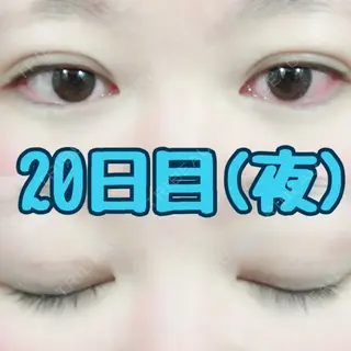 21日目の経過画像（2枚目）