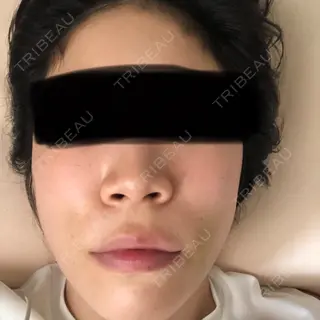 3日目の経過画像（1枚目）