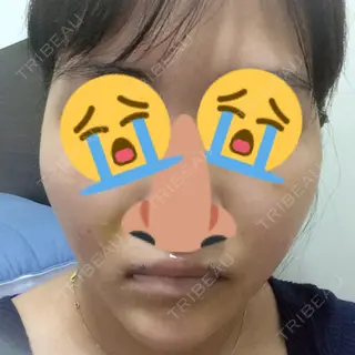 2日目の経過画像（1枚目）