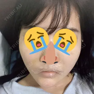 6日目の経過画像（1枚目）