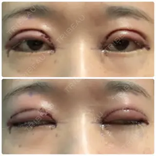 0日目の経過画像（3枚目）
