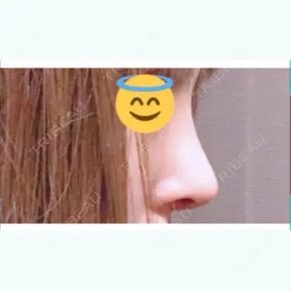 24日目の経過画像（2枚目）